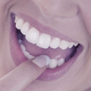 Esztétikus a fehér fogsor
